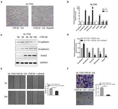 Histone Deacetylases Inhibit the Snail2-Mediated EMT During Metastasis of Hepatocellular Carcinoma Cells